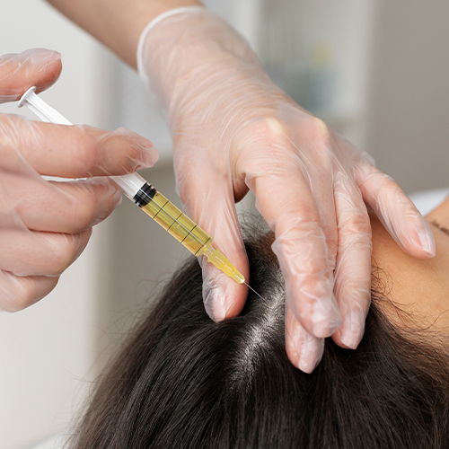 Close-up of doctor injecting hair growth serum in patient scalp